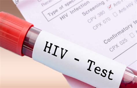 List of HIV Testing Centers in Metro Manila (NCR).